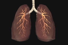 lung